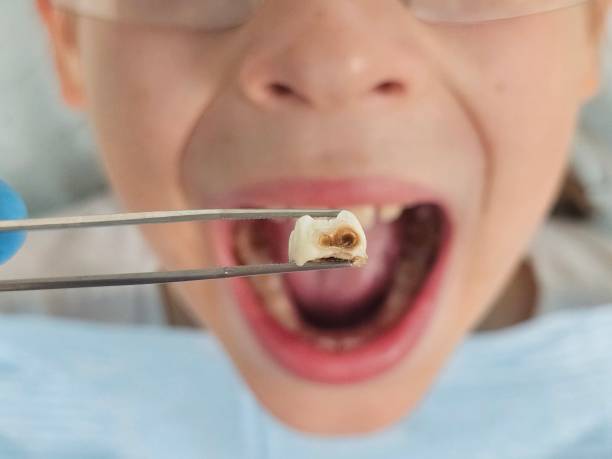 Best Emergency Dentist for Knocked-Out Tooth in Galena Park, TX
